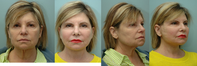 Facial Reconstructive Surgery  - 
	Facial Reconstructive Surgery
