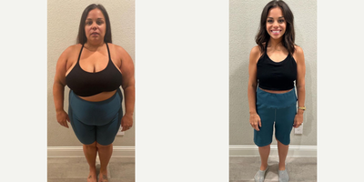 25-34 year old woman treated with Gastric Sleeve Surgery - Starting weight: 237 lbs. Pre op weight: 227 lbs. Current weight: 123 lbs.