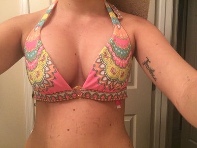 Chris Saunders MD  When Do I Wear a Bra after Breast Augmentation