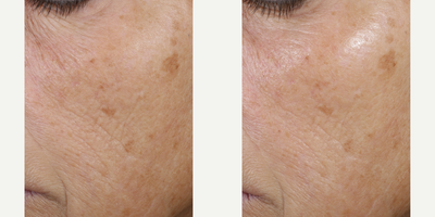 Skinbetter Science - Trio Rebalancing Moisture Treatment.Photo provided courtesy of Skinbetter Science.