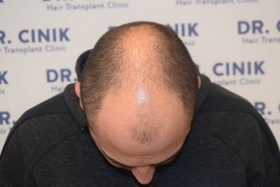 The Best Doctor Ever Emrah Cinik Md Review Realself