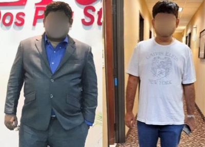 Man treated with Lap Band - Man treated with Lap Band, 1 year and 11 months post op. Helost51 lbs.