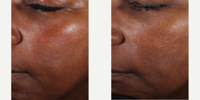 Skinbetter Science - Even Tone Correcting Serum.Photo provided courtesy of Skinbetter Science.