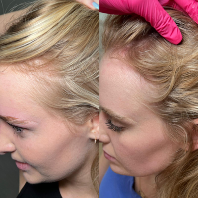 before and after image