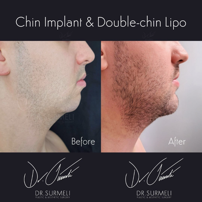 before and after image