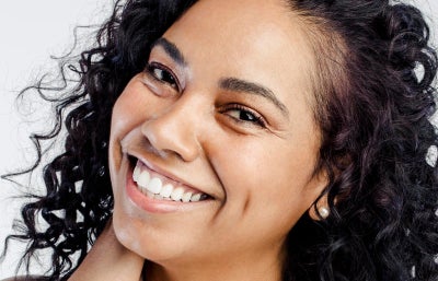 Smile Makeover