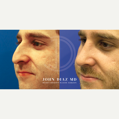 before and after image
