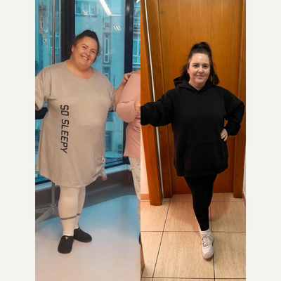 before and after image