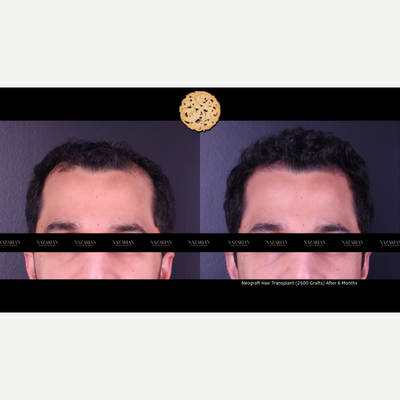 before and after image