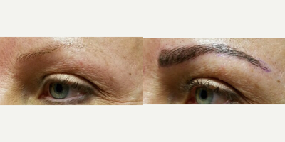 35-44 year old woman treated with Permanent Makeup - MicroBlading Before and After pictures by Dr. Deborah Sillins of Rejuvene Plastic Surgery in Northern Kentucky and Cincinnati.