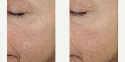 Skinbetter Science - Trio Rebalancing Moisture Treatment.Photo provided courtesy of Skinbetter Science.