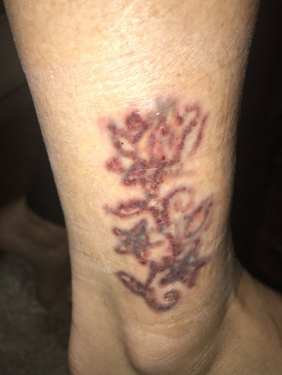 Tattoo Removal places near you in New Castle, DE - February, 2024