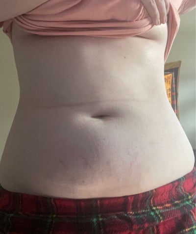 l-carnitine food Dr. Lipo+ Arrived Just Now!! : r/DIYaesthetics main image 0