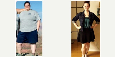 25-34 year old woman treated with Lap Band - Pre-op weight: 306 lbsTotal Weight Loss: 128 lbs