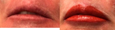 55-64 year old woman treated with Permanent Makeup - permanent makeup