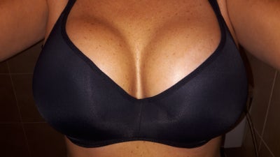 600cc silicone breast iimplants