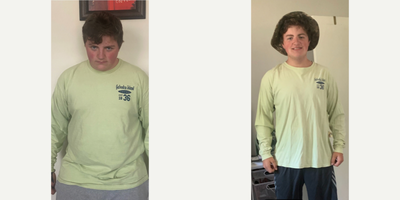Man: Ozempic for Weight Loss Front-View Transformation Ozempic before and after men transformation