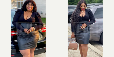 25-34 year old woman treated with Gastric Bypass, Gastric Sleeve Surgery - She lost more than 36 kilos in 10 months with Gastric Bypass.