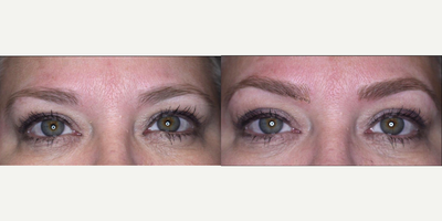 Microblading - A semi-permanent tattoo that resembles actual hairstrokes.