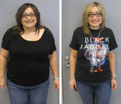 Before & After - 
	9 months post-op
