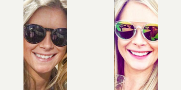 Straighten your teeth without braces - Photo provided courtesy of SmileDirectClub.