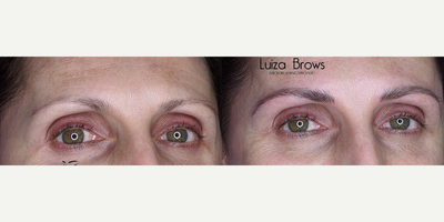 Woman treated with Microblading - Woman treated with Microblading