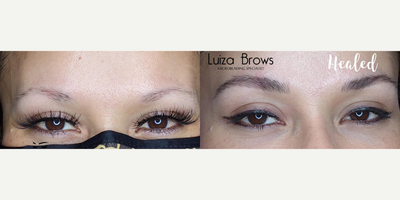 Woman treated with Microblading - Woman treated with Microblading