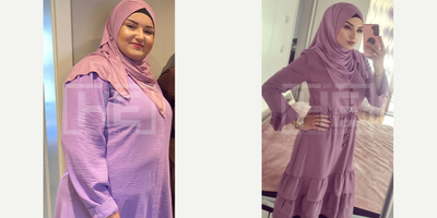 25-34 year old woman treated with Gastric Bypass - She lost more than 45 KG with Gastric Bypass Surgery at Dr HE Obesity Clinic in Turkey.