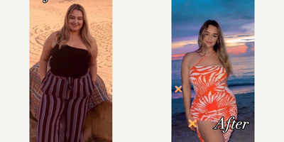 Woman treated with Gastric Sleeve Surgery - The best energy and with a strong desire to help many people improve their health.