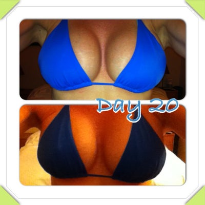 Going from a 34B to a 34C - Redondo Beach, CA - Review - RealSelf