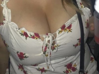 Itching - under my breasts?