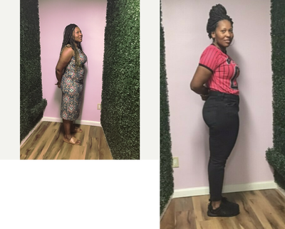 25-34 year old woman treated with Endoscopic Sleeve Gastroplasty - She lost 27 Lbs in 1 month after her Endoscopic Sleeve Gastroplasty Revision procedure.