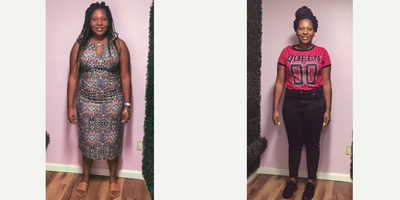 25-34 year old woman treated with Endoscopic Sleeve Gastroplasty - She lost 27 Lbs in 1 month after her Endoscopic Sleeve Gastroplasty Revision procedure.
