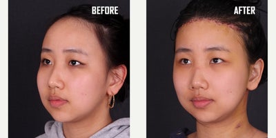 before and after image