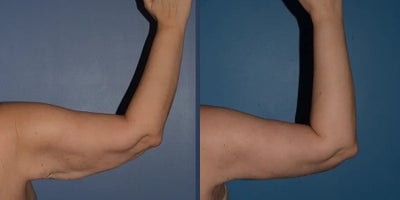 before and after image