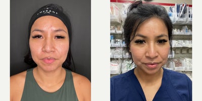 before and after image