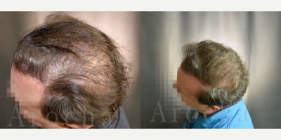 before and after image