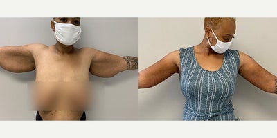before and after image