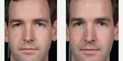 Clear and Brilliant before and after photo