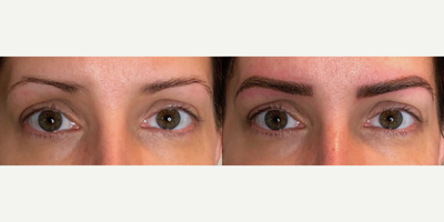 Microblading before and after photo