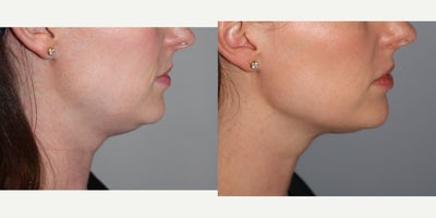 before and after image