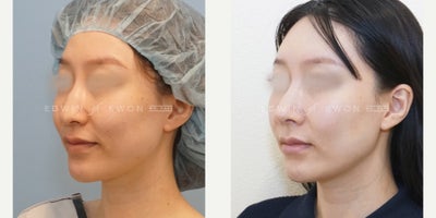 before and after image