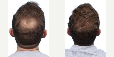 before and after image