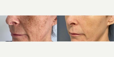 before and after image