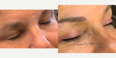 Permanent Makeup before and after photo