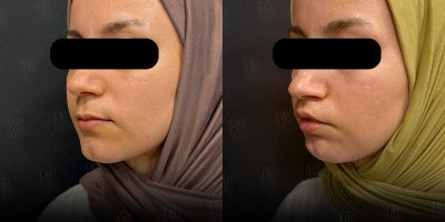 before and after image
