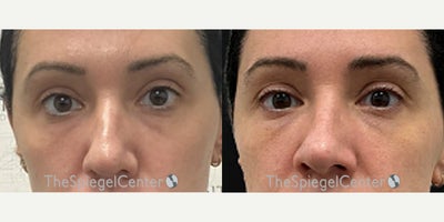 before and after image