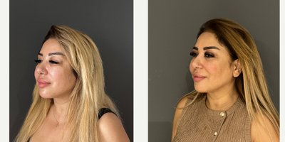 before and after image