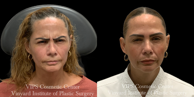 before and after image