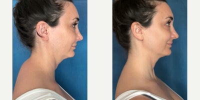 before and after image